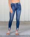 Katya High Rise Distressed Button Fly Jeans - Dark Wash
